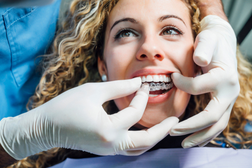 Invisalign provider placing a clear aligner on a woman's teeth.